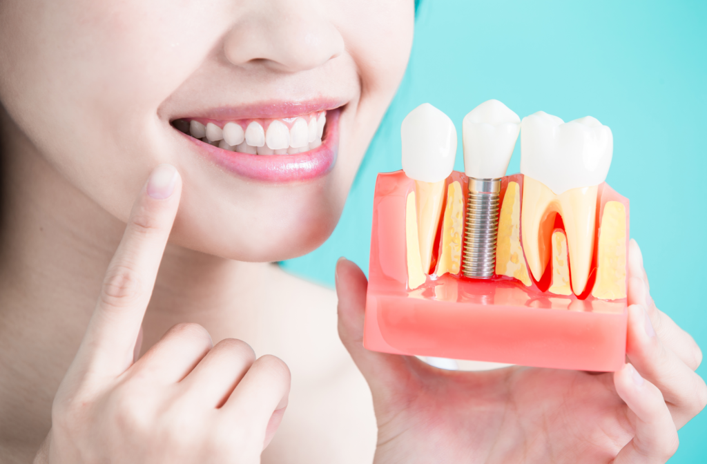 Happy woman holding dental implant model while pointing to her mouth